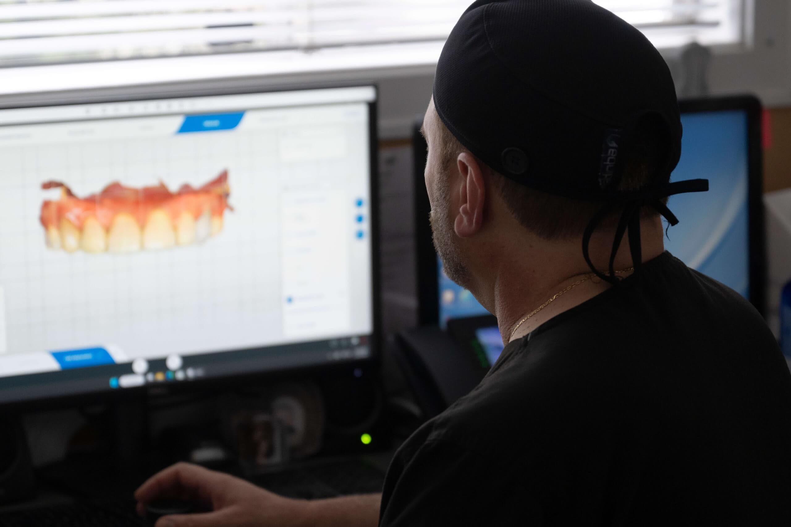 A dental professional reviews a 3D digital model of teeth and gums on a computer, showcasing advanced treatment planning technology.