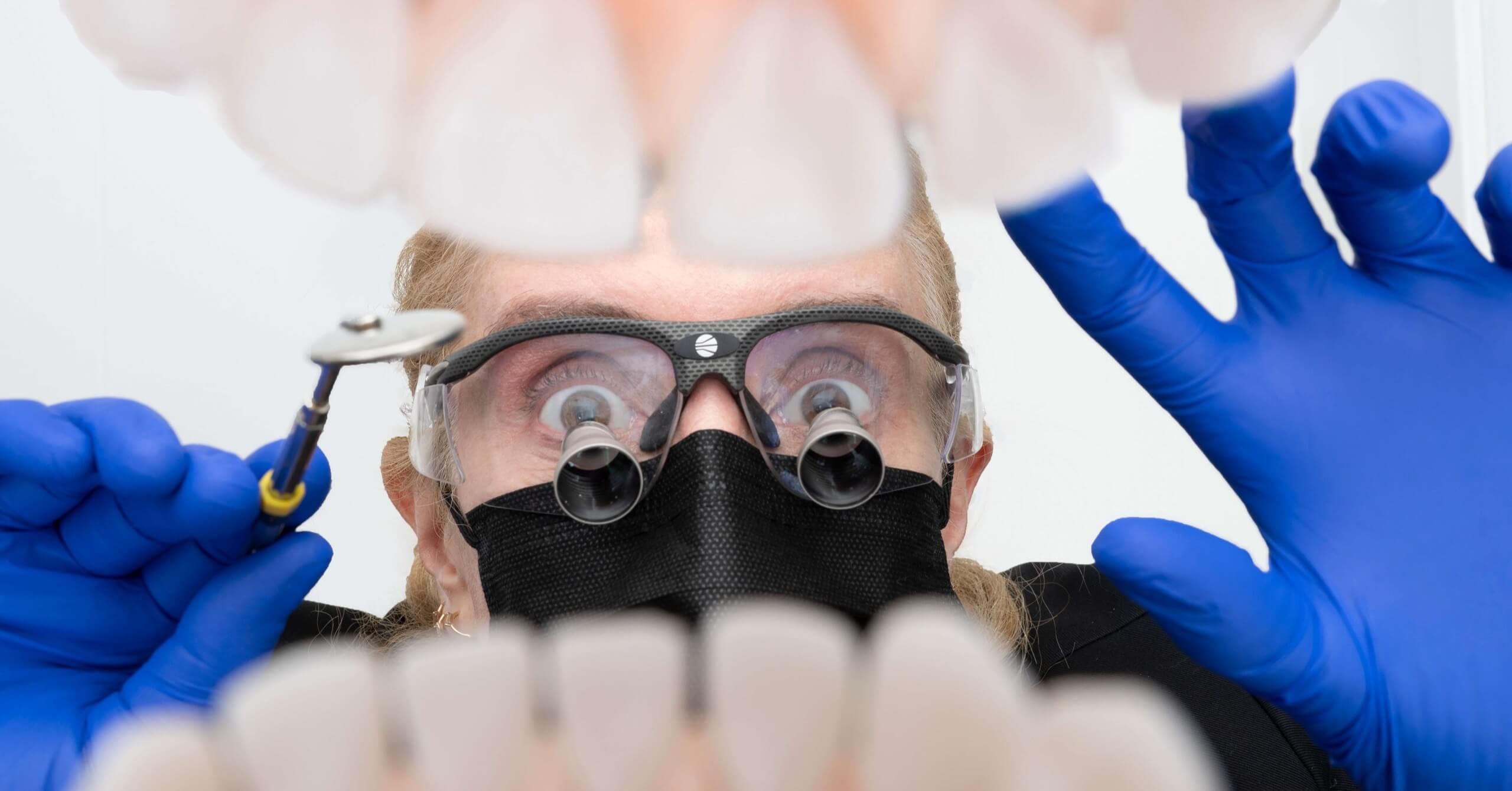 Close-up of a dentist wearing loupes and blue gloves during a gentle, precise exam; dental mirror and focused care in a bright San Anselmo cosmetic dentistry setting.